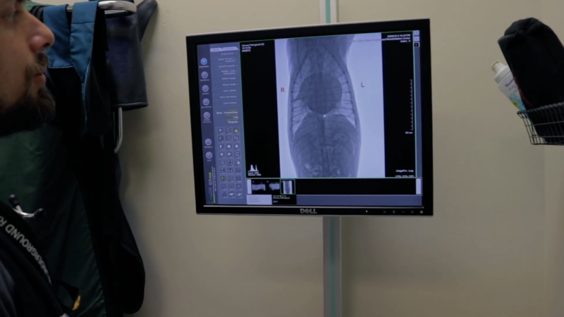 A Vet Examines an X-Ray Image of A Dog's Chest to Assess Potential Heart Issues